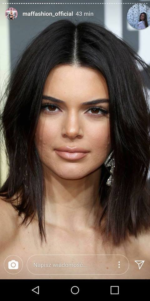 Co się dzieje z twarzą Kendall Jenner? (ZDJĘCIA) Co się dzieje z twarzą Kendall Jenner? (ZDJĘCIA)