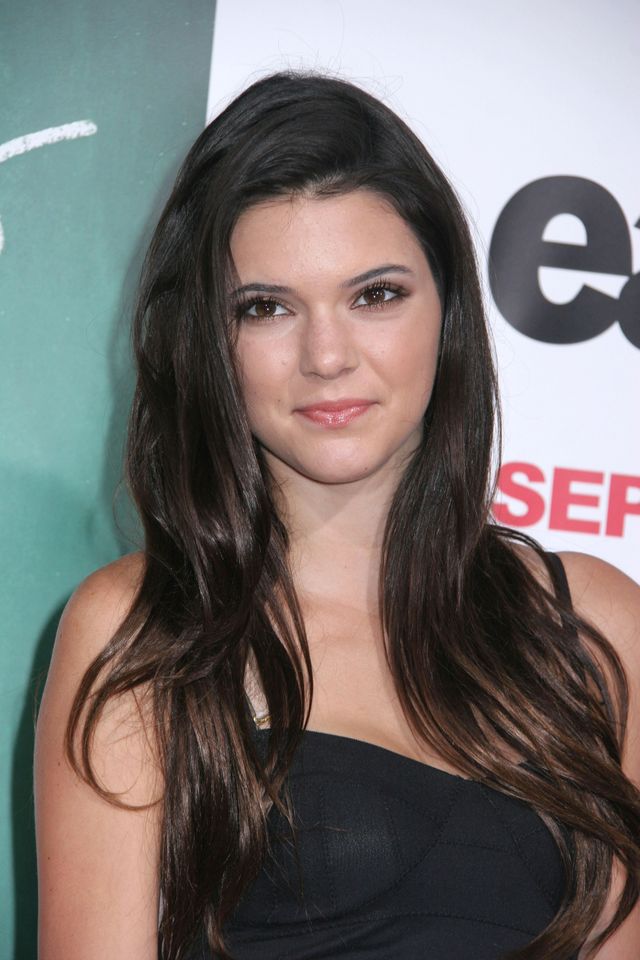 Trądzik i napompowane usta Kendall Jenner - zoom na twarz modelki Trądzik i napompowane usta Kendall Jenner - zoom na twarz modelki