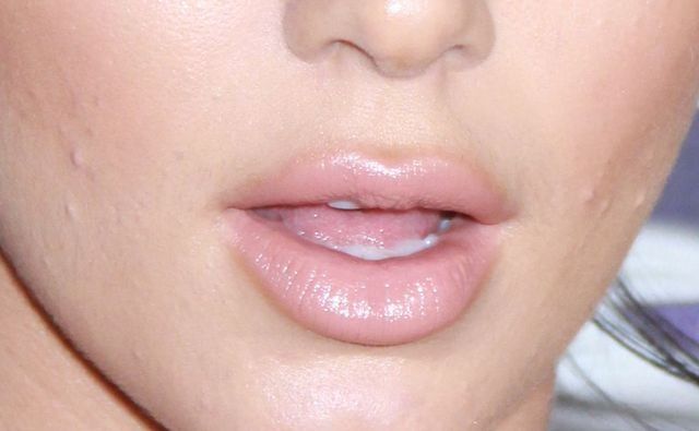 Trądzik i napompowane usta Kendall Jenner - zoom na twarz modelki Trądzik i napompowane usta Kendall Jenner - zoom na twarz modelki