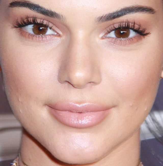Trądzik i napompowane usta Kendall Jenner - zoom na twarz modelki Trądzik i napompowane usta Kendall Jenner - zoom na twarz modelki
