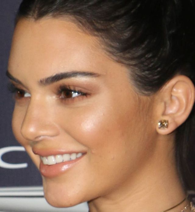 Trądzik i napompowane usta Kendall Jenner - zoom na twarz modelki Trądzik i napompowane usta Kendall Jenner - zoom na twarz modelki