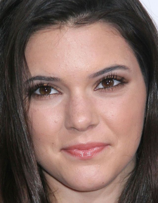 Trądzik i napompowane usta Kendall Jenner - zoom na twarz modelki Trądzik i napompowane usta Kendall Jenner - zoom na twarz modelki