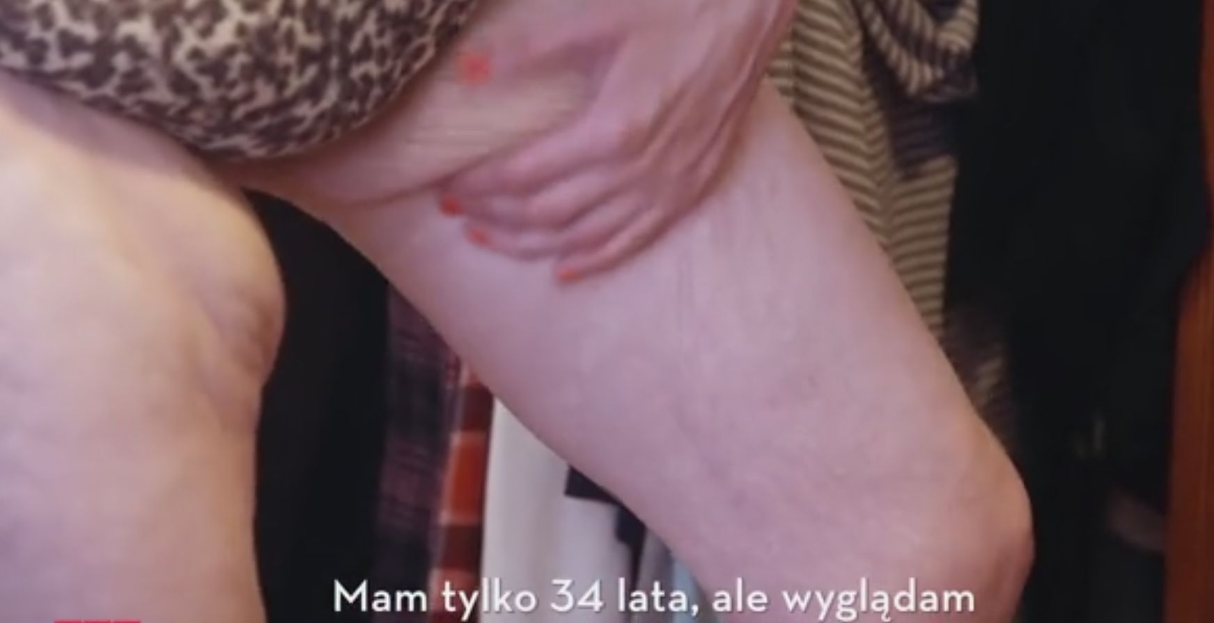 Jest ładna i dobrze wygląda, ale kiedy patrzy na ciało, widzi.. ohydną staruszkę