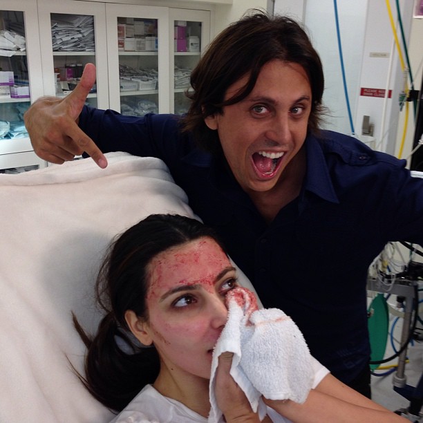 Kim Kardashian: Wampirzy lifting na wizji (FOTO)