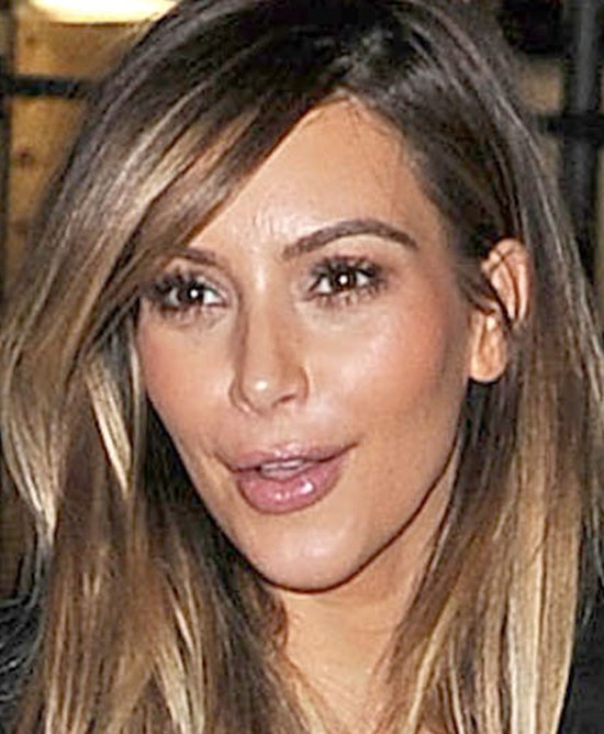 Kim Kardashian przesadziła z botoksem w okolicy ust (FOTO)