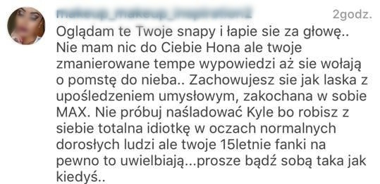 Honorata Skarbek na pre party MTV VMA w stylu Kylie