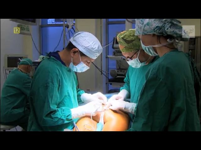 Uczestniczki Top Model pod skalpelem (FOTO)