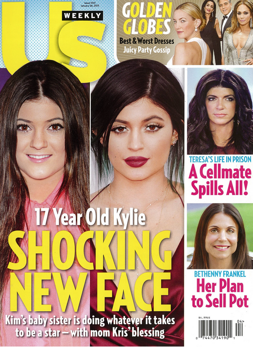 Nowa szokująca twarz Kylie Jenner 