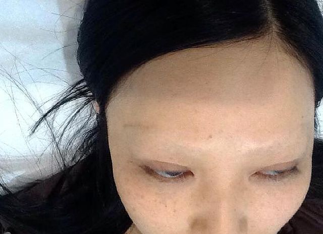 Uważaj na ten NIEBEZPIECZNY trend. Ta kobieta straciła przez niego brwi!