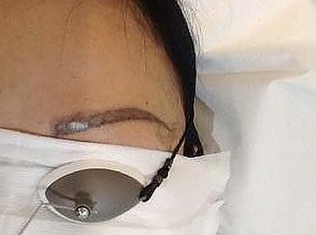 Uważaj na ten NIEBEZPIECZNY trend. Ta kobieta straciła przez niego brwi!