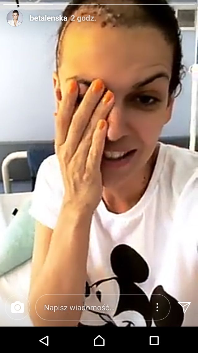 Alżbeta Lenska pokazała WIELKĄ bliznę po operacji (Instagram)