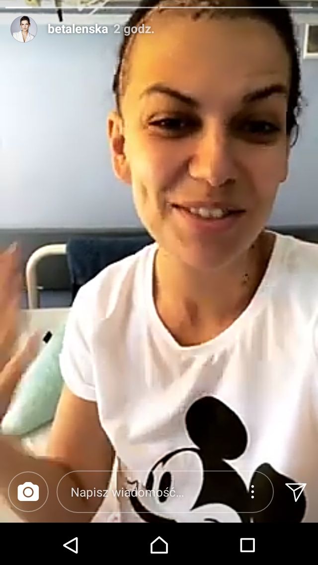 Alżbeta Lenska pokazała WIELKĄ bliznę po operacji (Instagram)