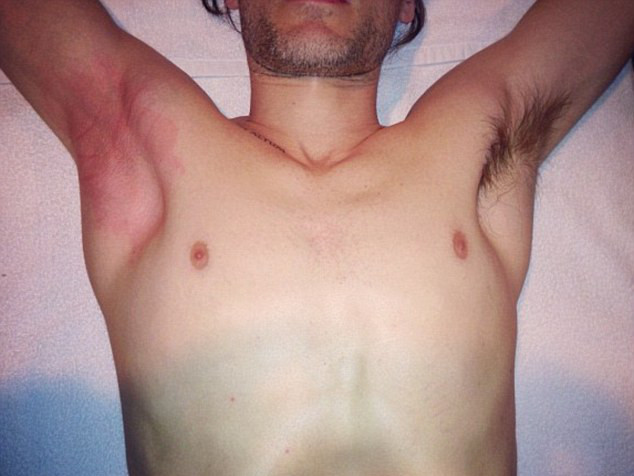 Całkowita depilacja brwi? To musiało boleć!