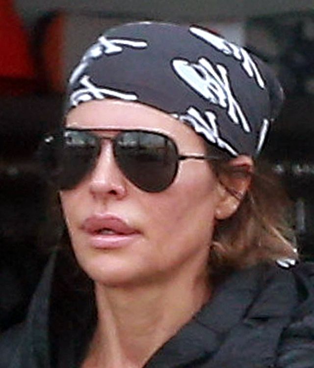 Nie wytrzymała długo bez spuchniętych ust (FOTO)