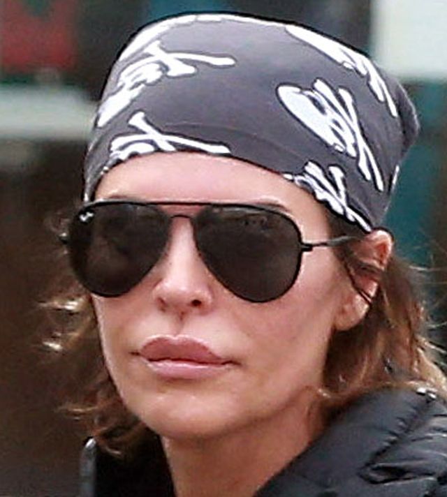 Nie wytrzymała długo bez spuchniętych ust (FOTO) Nie wytrzymała długo bez spuchniętych ust (FOTO)