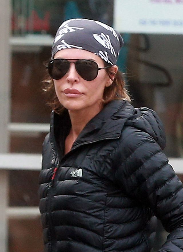 Nie wytrzymała długo bez spuchniętych ust (FOTO) Nie wytrzymała długo bez spuchniętych ust (FOTO)