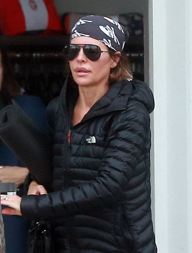 Nie wytrzymała długo bez spuchniętych ust (FOTO) Nie wytrzymała długo bez spuchniętych ust (FOTO)