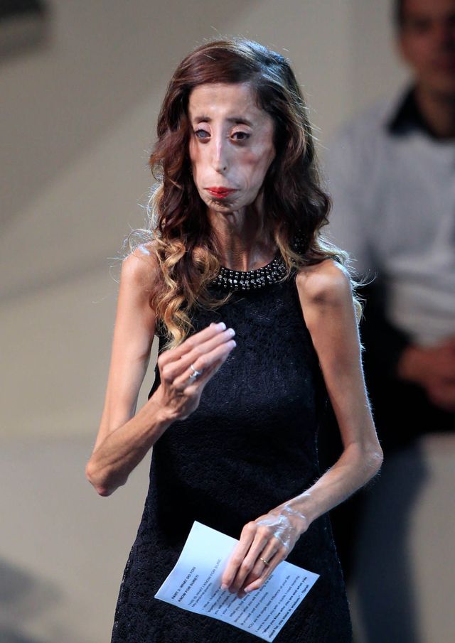 Lizzy Velasquez nie chce być bohaterką obraźliwych memów Lizzy Velasquez nie chce być bohaterką obraźliwych memów