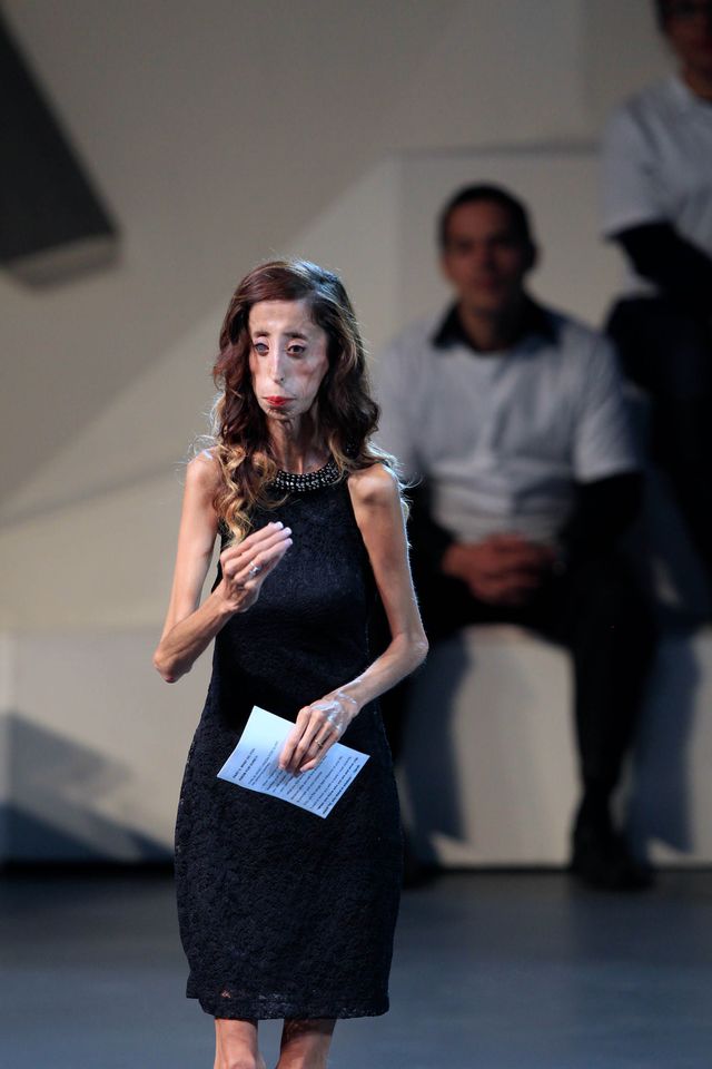 Lizzy Velasquez nie chce być bohaterką obraźliwych memów Lizzy Velasquez nie chce być bohaterką obraźliwych memów