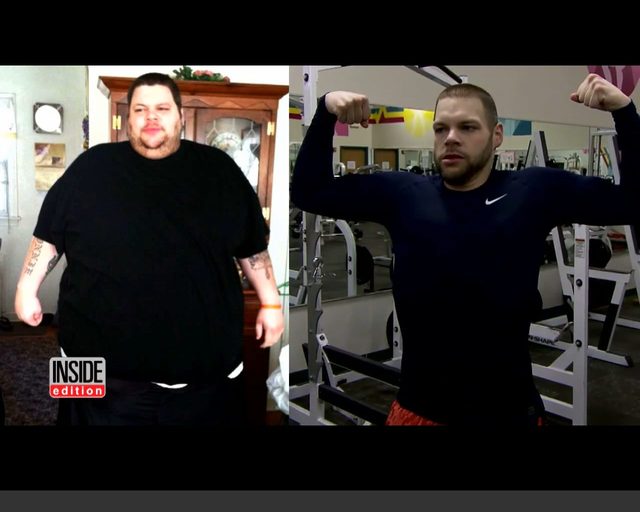 Schudł 190 kg, lekarze wycięli mu 15 kilo wiszącej skóry