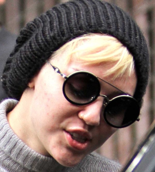 Miley Cyrus ma problemy z cerą (FOTO)