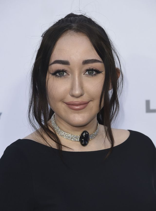 17-letnia Noah Cyrus jest po KILKU operacjach plastycznych? (ZDJĘCIA)
