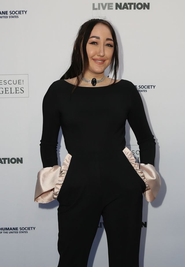 17-letnia Noah Cyrus jest po KILKU operacjach plastycznych? (ZDJĘCIA)