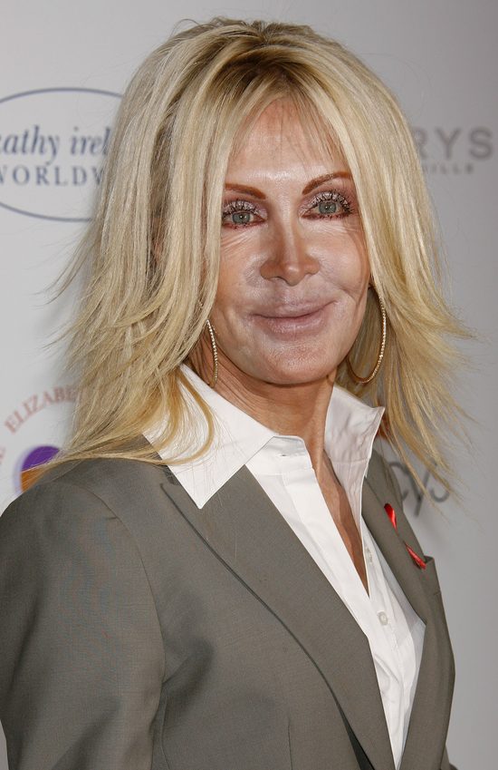 Joan Van Ark powinna zwolnić chirurga i makijażystę