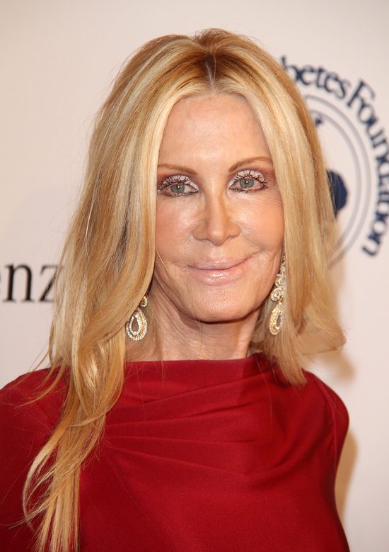 Joan Van Ark powinna zwolnić chirurga i makijażystę