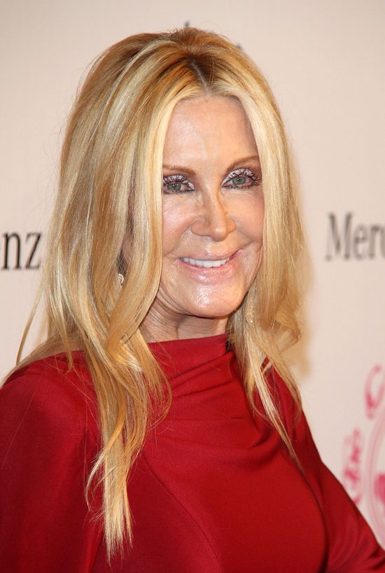 Joan Van Ark powinna zwolnić chirurga i makijażystę