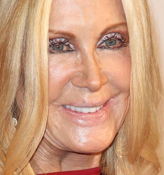 Joan Van Ark powinna zwolnić chirurga i makijażystę