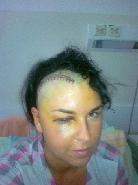 Aktorka z Miłości nad rozlewskiem walczy z rakiem (FOTO)