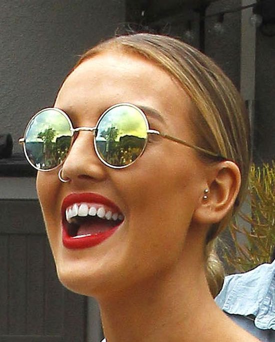 Nie widzieliśmy jej z aparatem, a nagle jej zęby wyprostowały się 