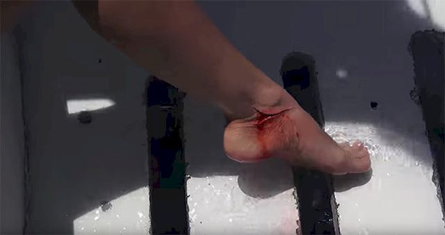 Porn Gwiazda zaatakowana przez REKINA! Przerażające wideo!