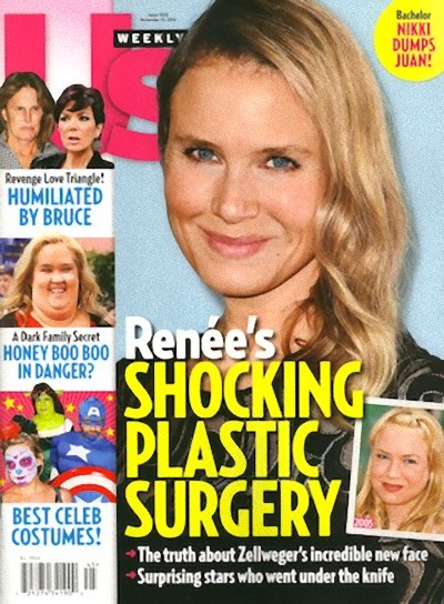 Renee Zellweger zmieniła twarz dla... pieniędzy?