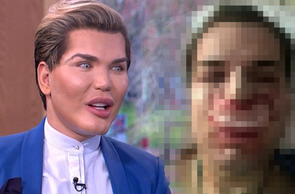 Żywemu Kenowi ODPADA NOS! Rodrigo Alves przesadził z operacjami