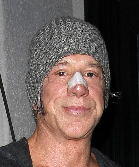 O rany. Mickey Rourke przeszedł chyba setną operację (FOTO) O rany. Mickey Rourke przeszedł chyba setną operację (FOTO)
