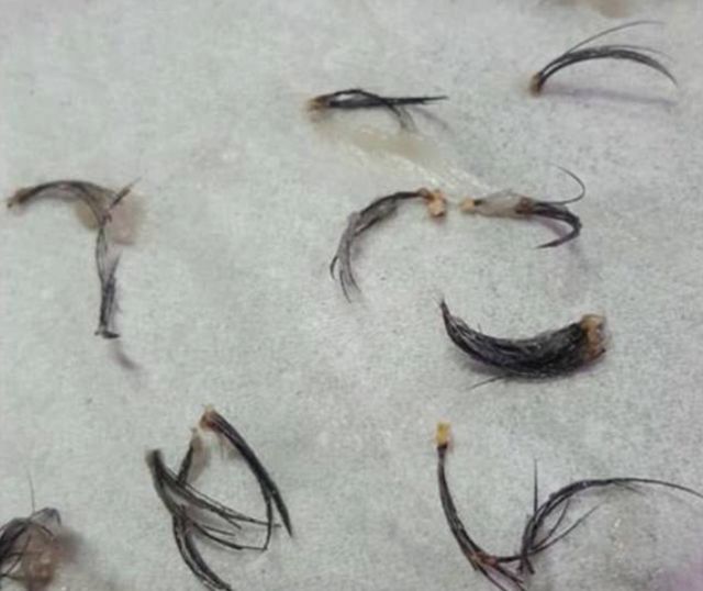 Zobacz, co stało się jej po przedłużaniu rzęs! SZOK!