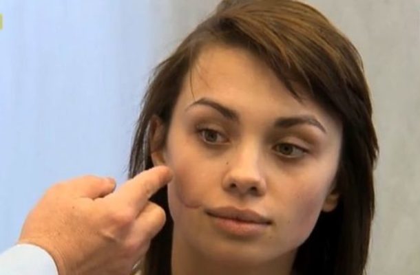 Uczestniczki Top Model pod skalpelem (FOTO)