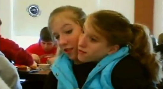 Zrośnięte tułowiem siostry Hensel wystąpią w reality show Zrośnięte tułowiem siostry Hensel wystąpią w reality show