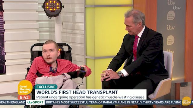 Pierwsza w historii transplantacja CAŁEJ GŁOWY jest możliwa?! (VIDEO) Pierwsza w historii transplantacja CAŁEJ GŁOWY jest możliwa?! (VIDEO)