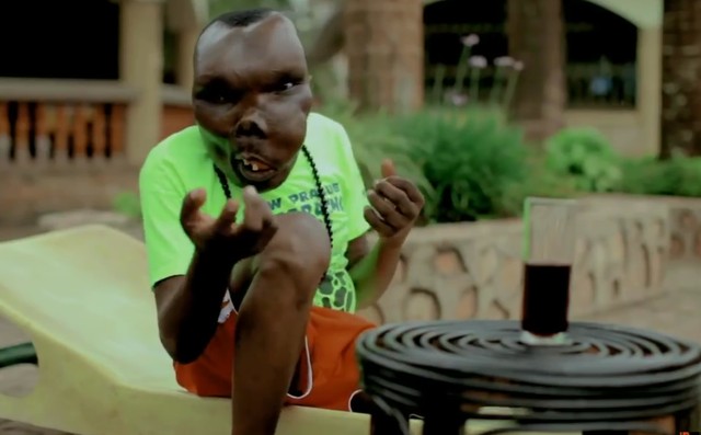 Najbrzydszy człowiek świata został ojcem (VIDEO)