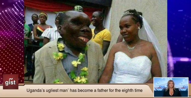 Najbrzydszy człowiek świata został ojcem (VIDEO)