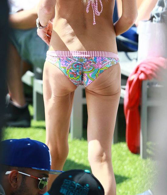 Nie tylko brzuch ma mało apetyczny (FOTO)