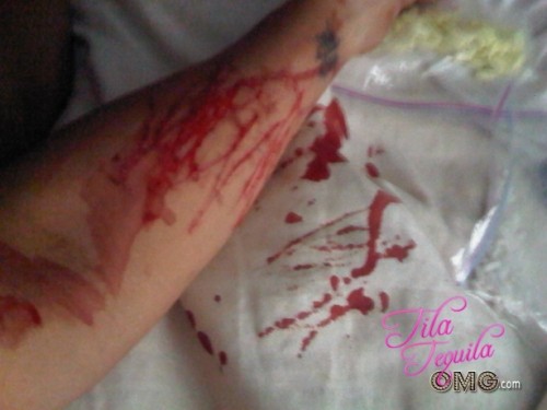 Jeszcze niedawno chciała się zabić, teraz jest w ciąży 