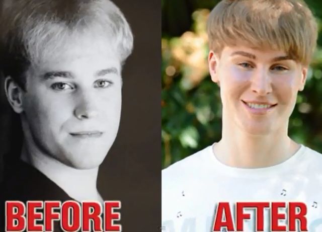 Toby Sheldon wydał fortunę, by wyglądać jak Justin Bieber! 