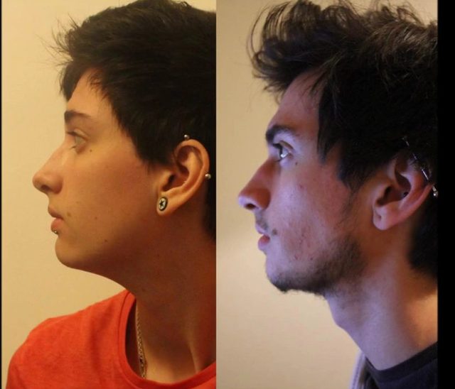 Ten chłopak zmienił płeć. Przemianę utrwalił na zdjęciach