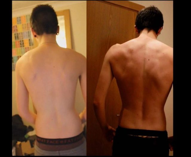 Ten chłopak zmienił płeć. Przemianę utrwalił na zdjęciach