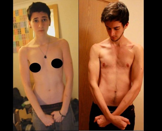 Ten chłopak zmienił płeć. Przemianę utrwalił na zdjęciach