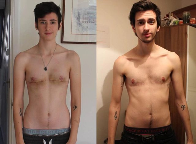 Ten chłopak zmienił płeć. Przemianę utrwalił na zdjęciach